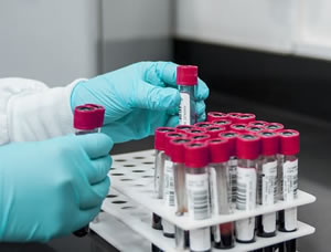 Serum Plasma Samples